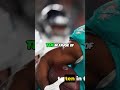 Week 2 NFL: BILLS DOMINATE: Thrilling Victory Over Dolphins Explained🏈✌️#shorts #nfl #highlights