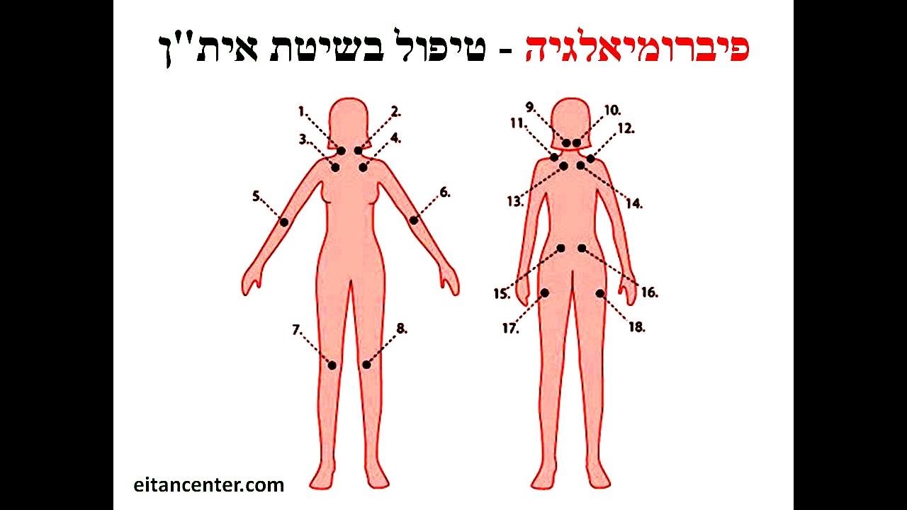 טיפול יעיל לפיברומיאלגיה בשיטת אית