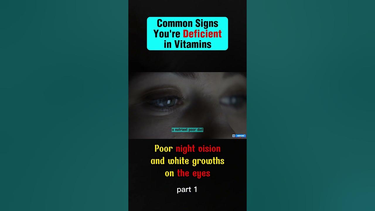 shorts Poor Night Vision And White Growths On The Eyes 1 trending shorts-poor-night-vision-and-white-growths-on-the-eyes-1-trending
