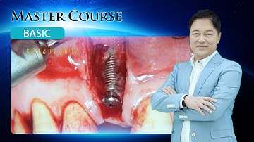 [Master Course - BASIC] Considerations for Successful GBR