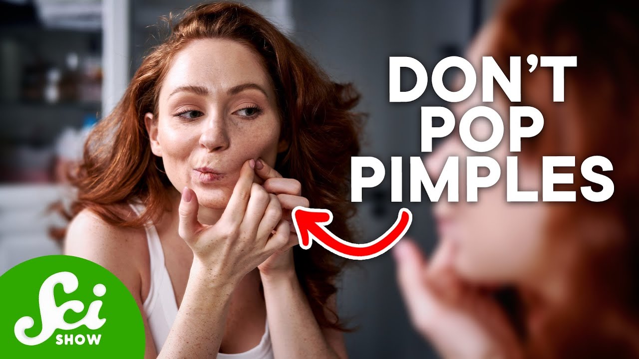 how to get rid of acne and keep it from coming back