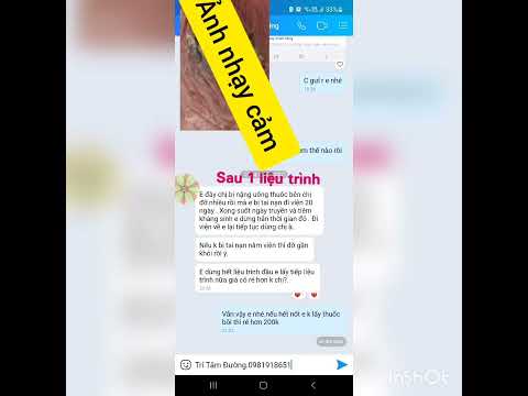 Video Trị sùi mào gà nhanh bằng cách đốt nhưng tái phát lại... - youtube