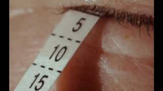 getoct_Schirmer dry eye test.mp4