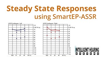 IHS Training Session: Auditory Steady State Response Acquisition (ASSR)