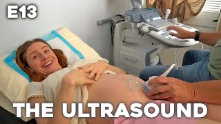 HOME BIRTH BOUND: My Pregnancy Journey - E13: The Ultrasound