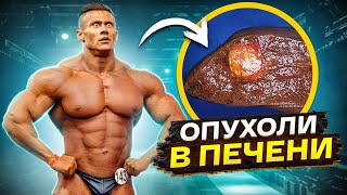 ОПУХОЛИ РАЗМЕРОМ С ТЕННИСНЫЙ МЯЧ / Денис Бажанов