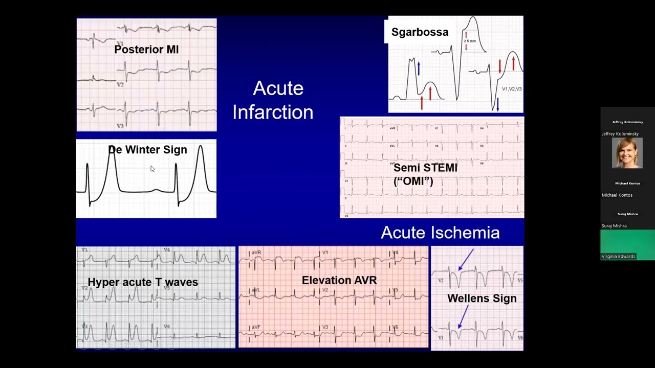 Evaluation of Chest Pain in the Emergency Department: Guidelines & Consensus Decision Pathways