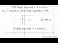 ECG Interpretation - Time and the ECG - Part 1