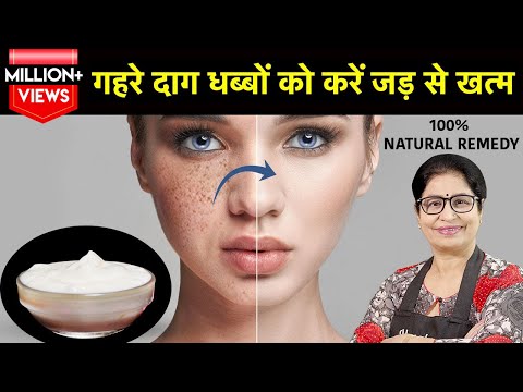 वीडियो: कैसे जल्दी से अपने चेहरे पर एक मुर्गी से छुटकारा पाने के लिए