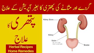 PATHRI ka Ilaj | Kidney & Bladder Stone Treatment in Urdu/Hindi | Home Remedies | Malik Ahmad Farooq