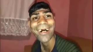 Hiko 10 Saniye Boyunca Kuraa Diyor