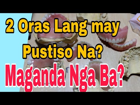 Video: 3 Mga paraan upang Pansamantalang Ayusin ang isang Loose Wire sa Iyong Mga Brace