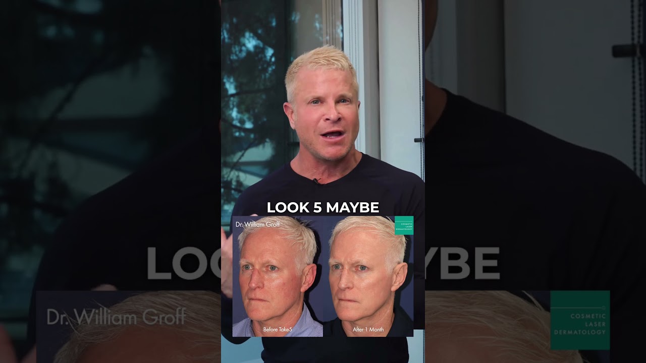 Banner for How to Look Younger with One Skin Treatment in Your 30s or 40s | Take5 Treatment #sunspots #skin