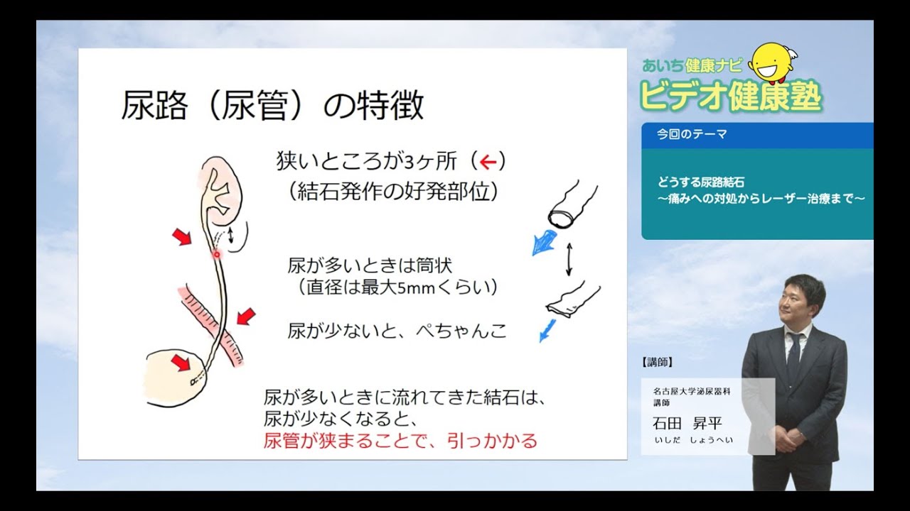 どうする尿路結石～痛みへの対処からレーザー治療まで～