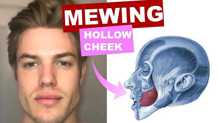 MEWING for Hollow Cheeks | How to get a DEFINED FACE