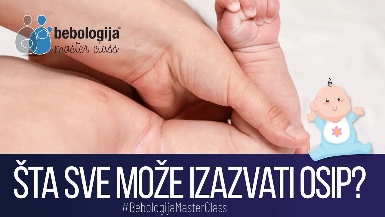 Šta sve može izazvati osip?