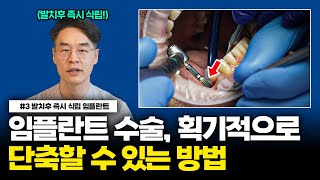 뼈이식? 임플란트 식립? 단 하루면 끝납니다 / 서울대 치과 의사가 알려주는 &quot;발치 후 즉시 식립 임플란트&quot;