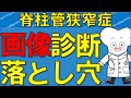 脊柱管狭窄症、腰痛は画像検査だけで診断できない MRIだけに頼る病院の落とし穴【医師が解説】