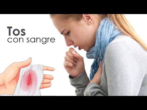 Vídeo: Toser Sangre: Que Puede Ser Y Que Hacer, Razones, Video