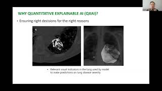 Spark Virtual Seminar: A Transparency- and Trust-Centric Design Approach to AI for Healthcare