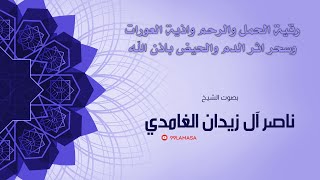 رقية الحمل و الرحم و اذية العورات و سحر اثر الدم  و الحيض بإذن الله - الشيخ ناصر الزيدان الغامدي ~