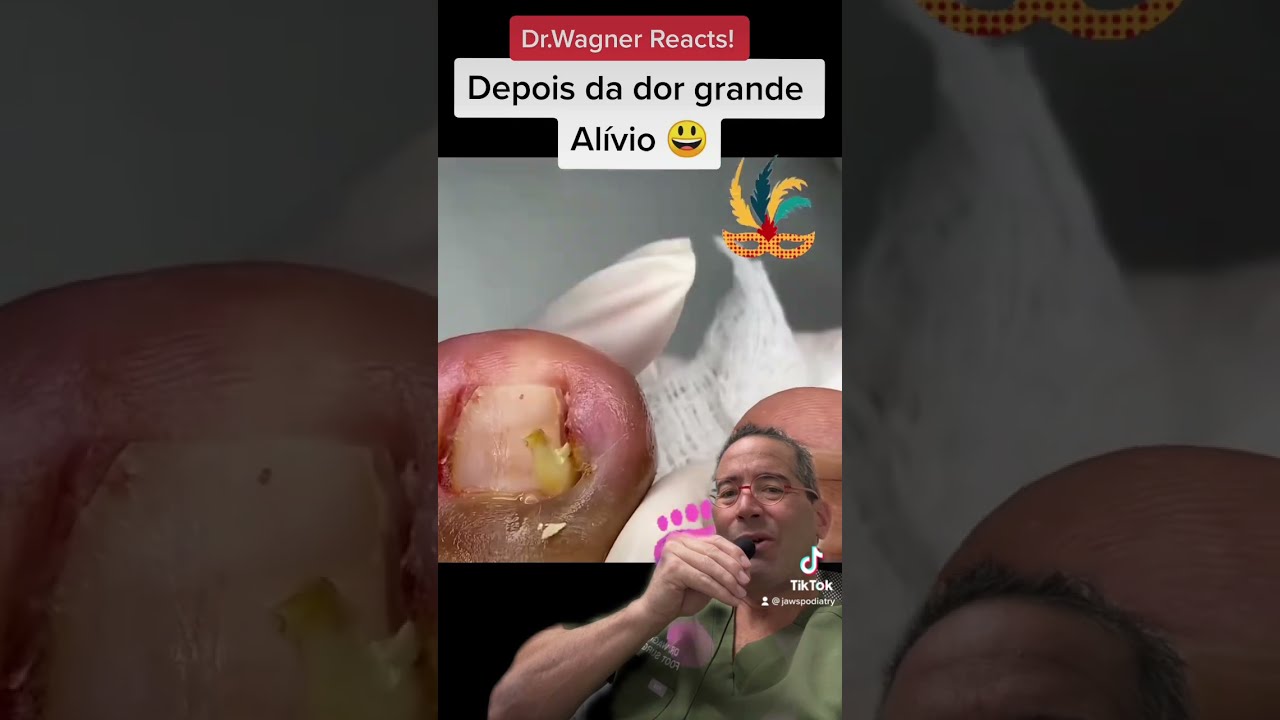 SUPER ANGRY INGROWN TOENAIL EXTRACTION Shorts