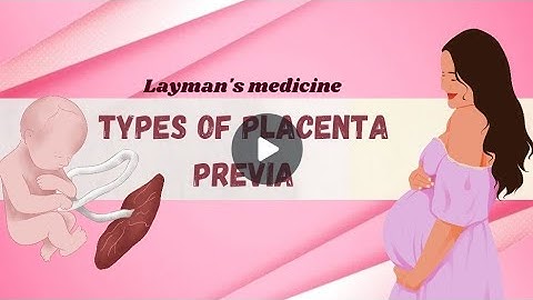 Types of Placenta Previa // English animation