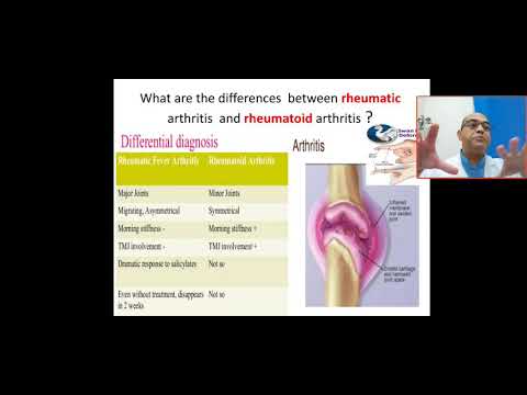 what are the differences between rheumatic fever arthritis and rheumatoid arthritis? migratory,