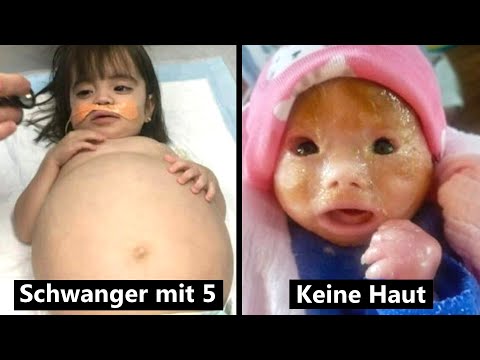 8 echte Kinder mit einem unglaublichen Schicksal