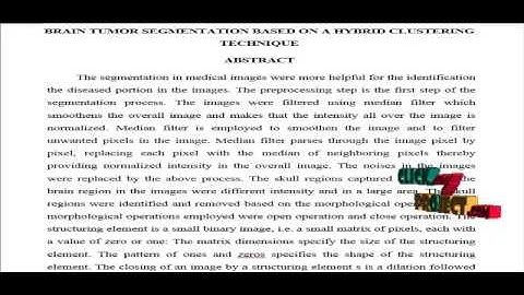 Brain tumor segmentation based on a hybrid clustering technique | Final Year Projects 2016