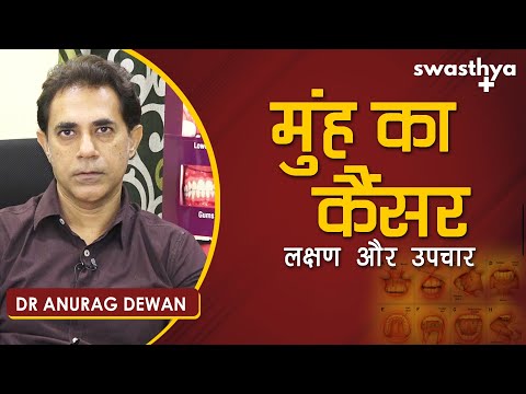 ओरल कैंसर – लक्षण, कारण, रोकथाम | Dr Anurag Dewan on Oral Cancer in Hindi | Symptoms & Treatment