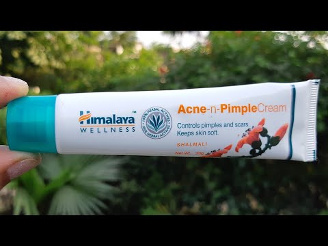 Himalaya herbals acne & pimple cream review, anti acne cream for summers for everyone