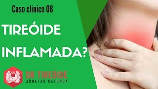 Lado glândula do direito inchada tireóide