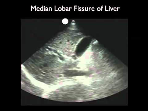 How To: Gallbladder Ultrasound Part 1 - Introduction Case Study Video