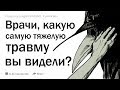 Врачи, какую самую тяжелую травму вы встречали на обычном осмотре?