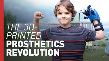 3D-Printed Bionic Hands are Changing Kids