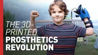 3D-Printed Bionic Hands are Changing Kids' Lives | Freethink Superhuman Profile