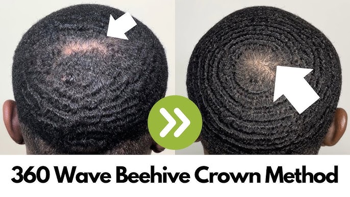 😱😱360 Waves: How To Fix A Bald Spot In Your Hair (Crown) COARSE