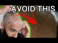 HEAD SHAVING FOR SENSITIVE SKIN - How Would Your Skin React To Razor Shaving EVERY DAY? A Experiment