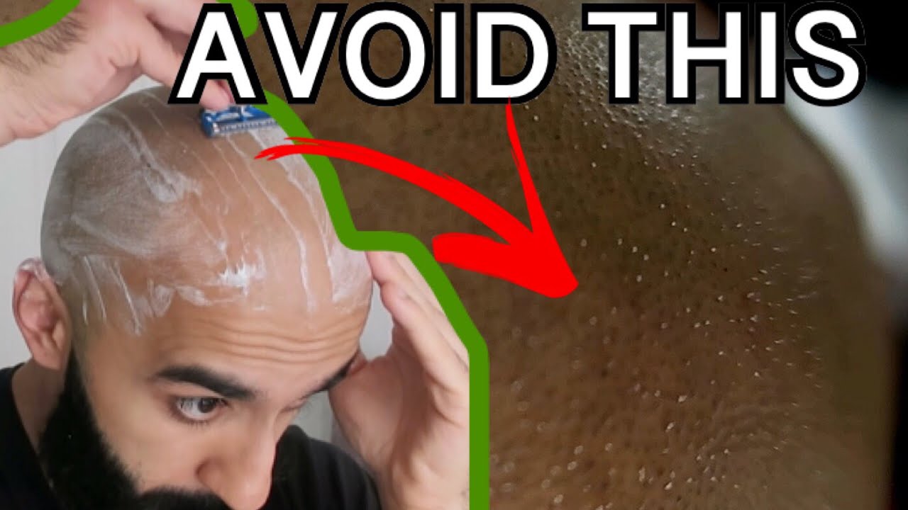 HEAD SHAVING FOR SENSITIVE SKIN How Would Your Skin React To Razor