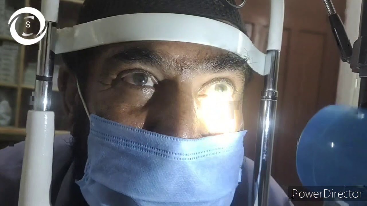 Relative afferent pupillary defect RAPD - YouTube