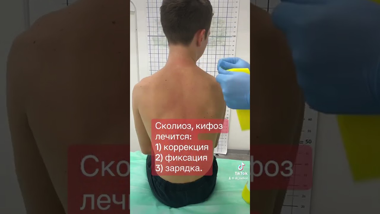 Как лечить сколиоз у подростка.￼