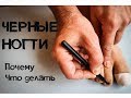 Черные ногти у бегунов. Почему и что делать