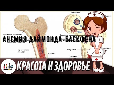Анемия Даймонда-Блекфена