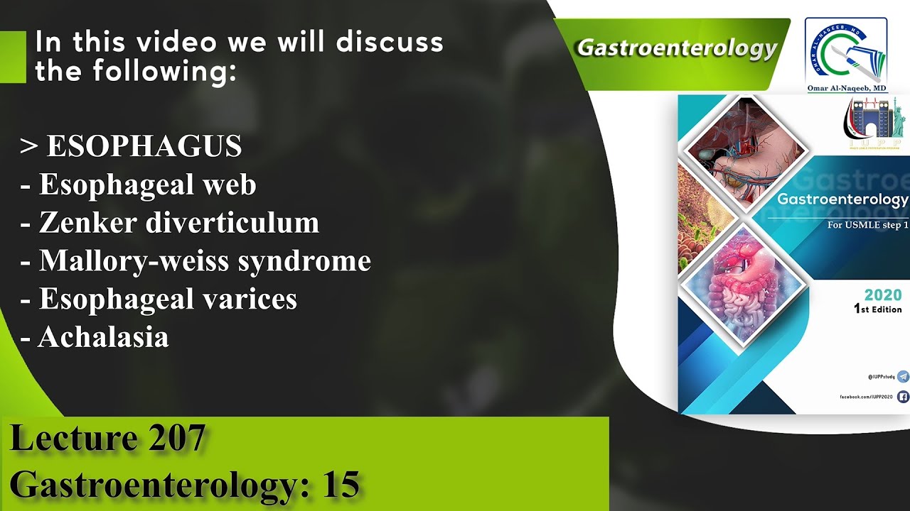Esophageal web Zenker diverticulum Malloryweiss syndrome