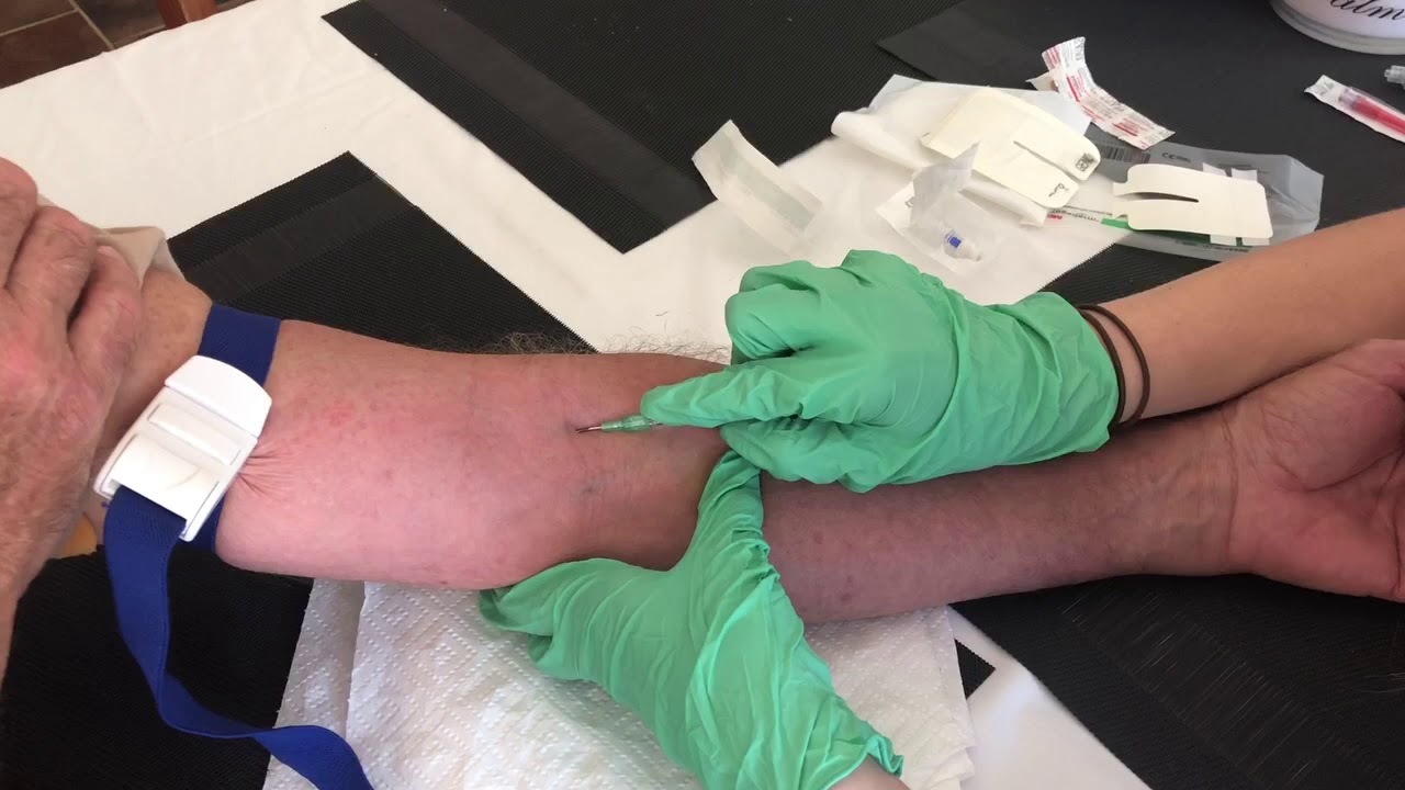 IV Cannulation YouTube