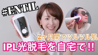 【ENTIL脱毛器】コスパ最強のセルフ脱毛♪2ヶ月使った効果は⁇