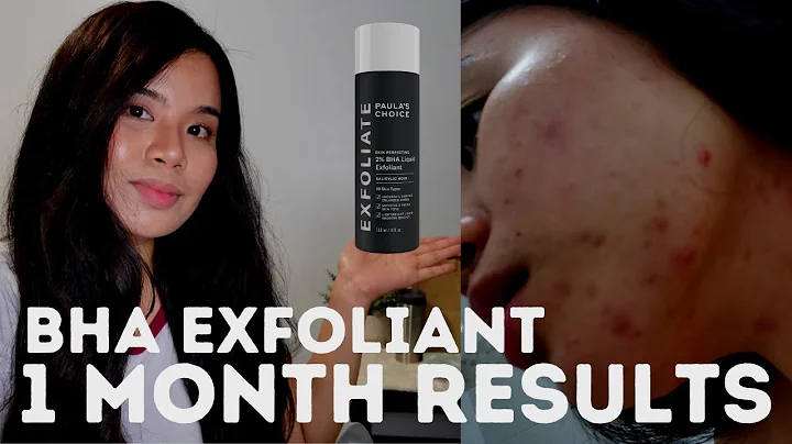 I tried PAULA'S CHOICE 2% BHA LIQUID EXFOLIANT for A MONTH (Acne prone skin) RESULTS | Lica tries
