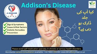 Addison's disease, Causes, Signs & Symptoms and Holistic Remedies for long-term wellness
