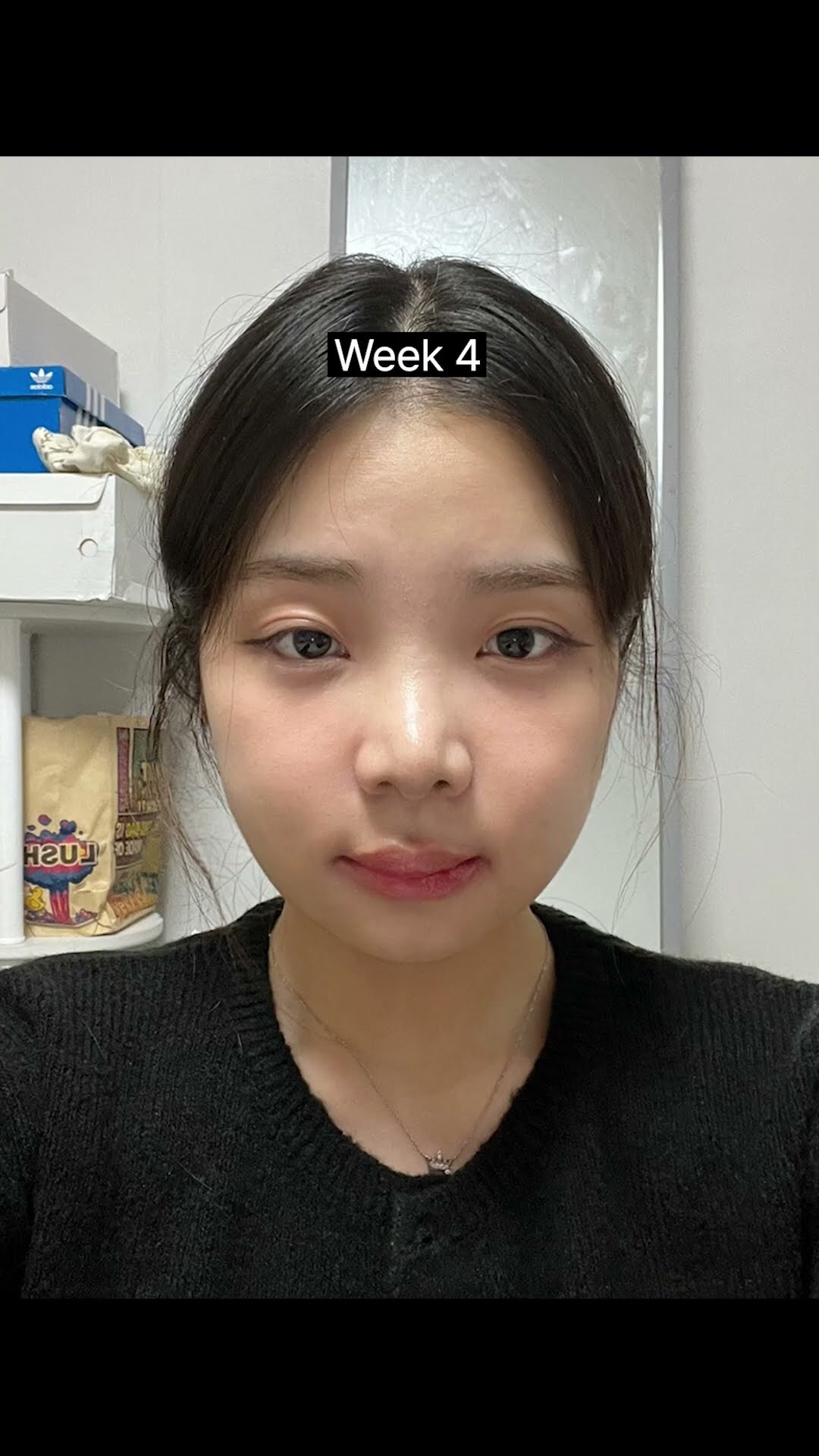 등록한썸네일